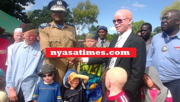 Malawi Police Register Albinos To End Horrific Trade In Body Parts 